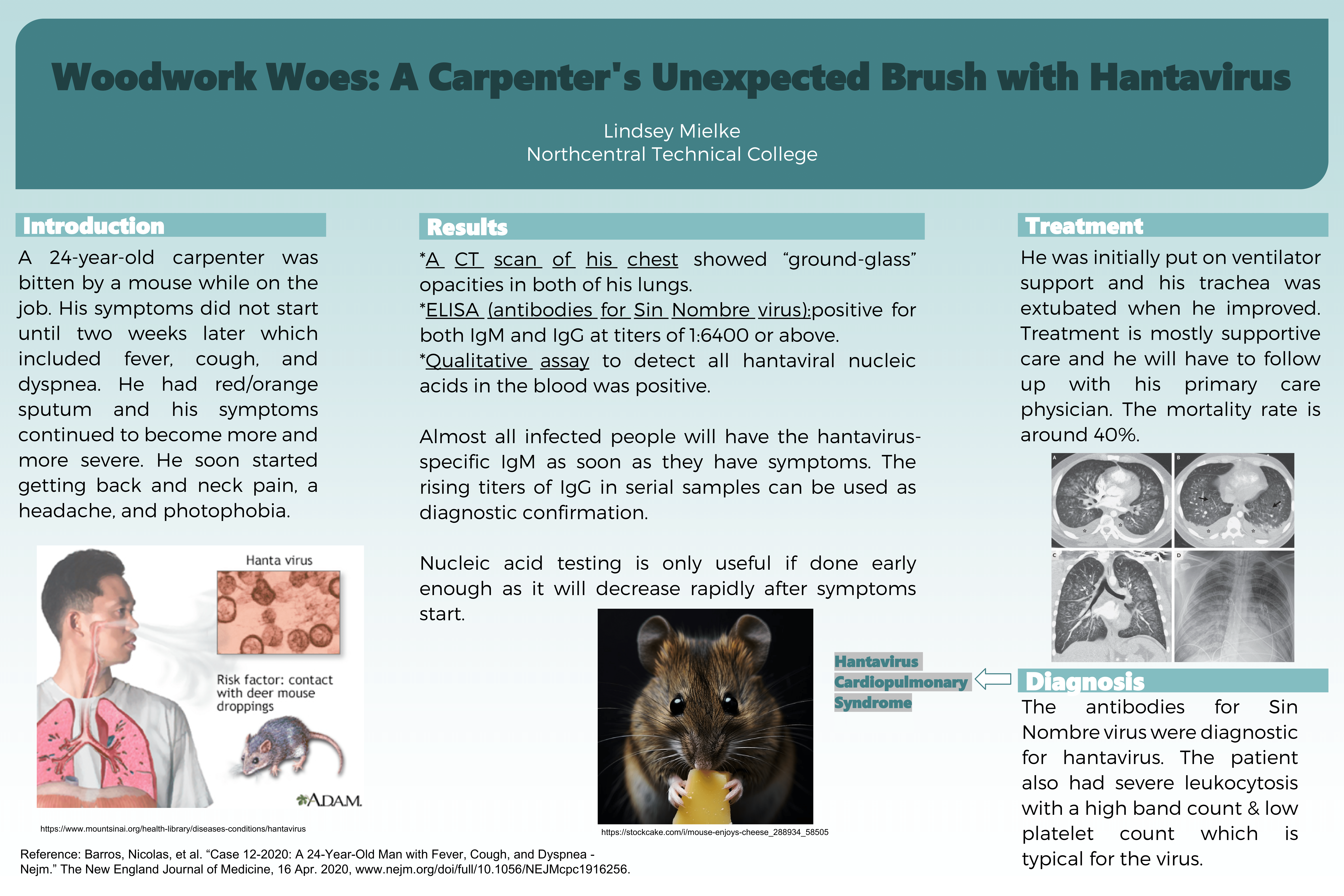 Woodwork Woes: A Carpenter's Unexpected Brush with Hantavirus poster by Lindsey Mielke