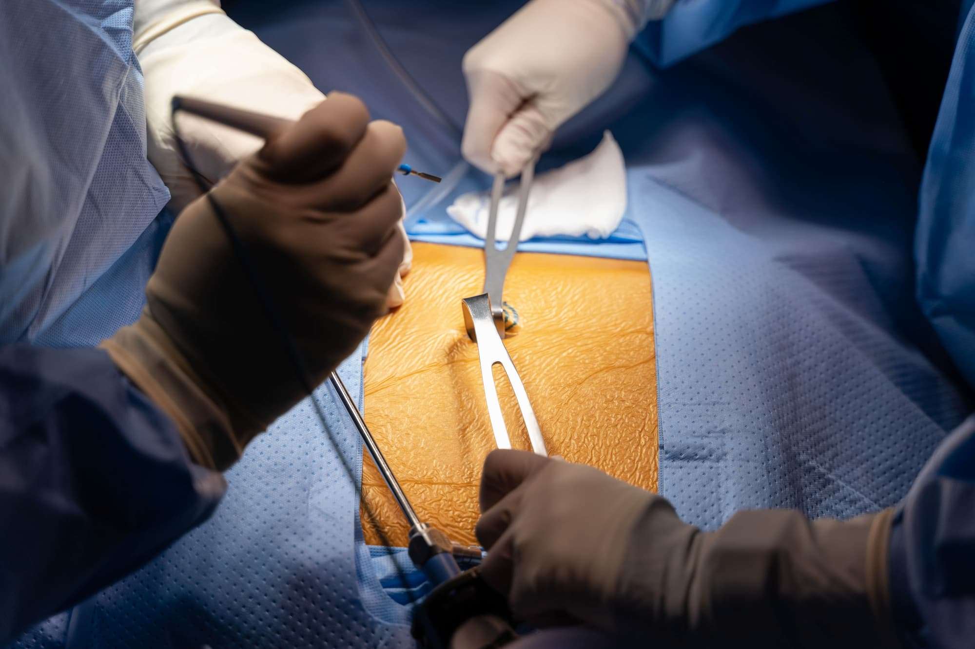 Two students start a mock operation by placing retractors on an incision on a mannequin.