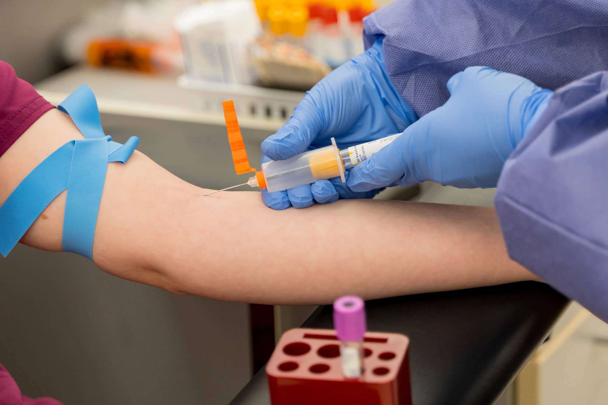 A close-up of a syringe inserted into a patient's forearm.